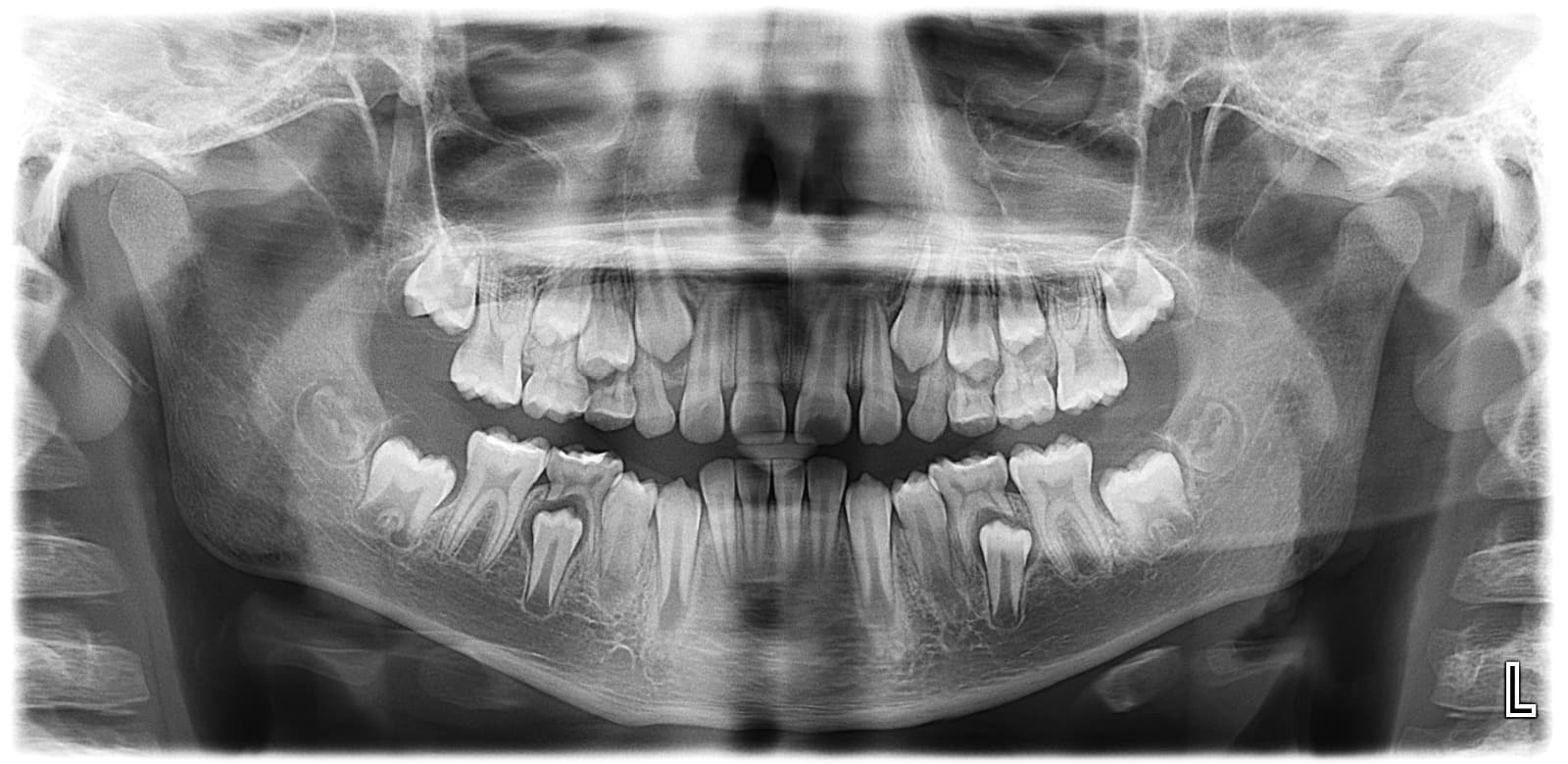 Radiografía panorámica de la estructura dental