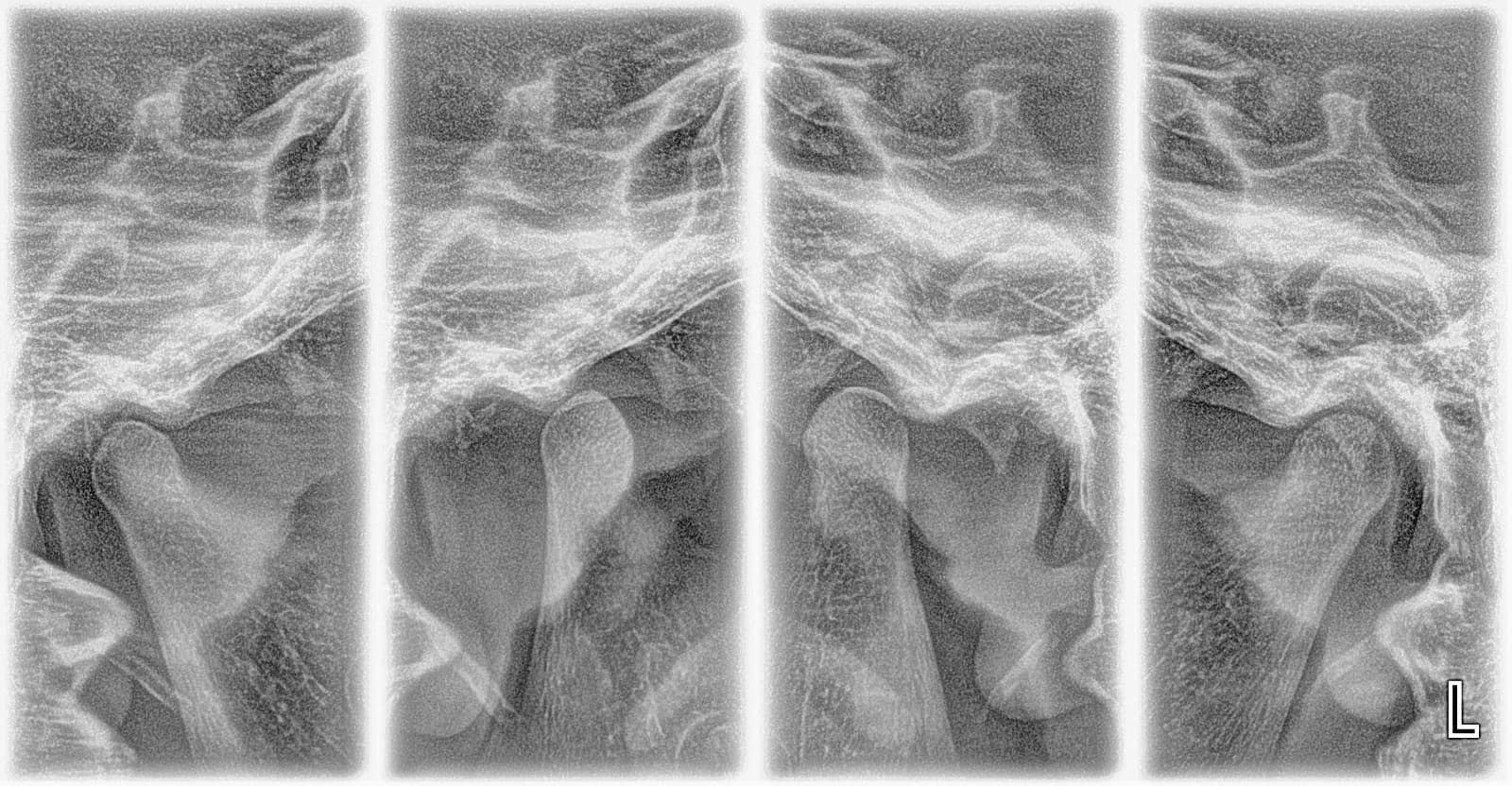 Radiografías de detalle de la articulación mandibular