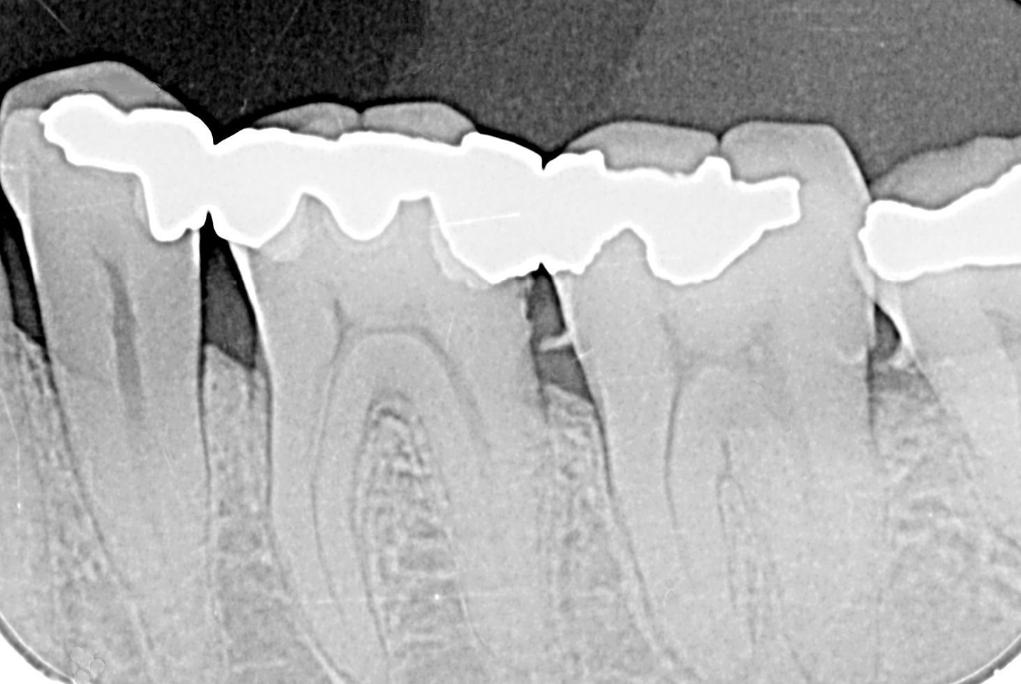 Radiografía dental panorámica